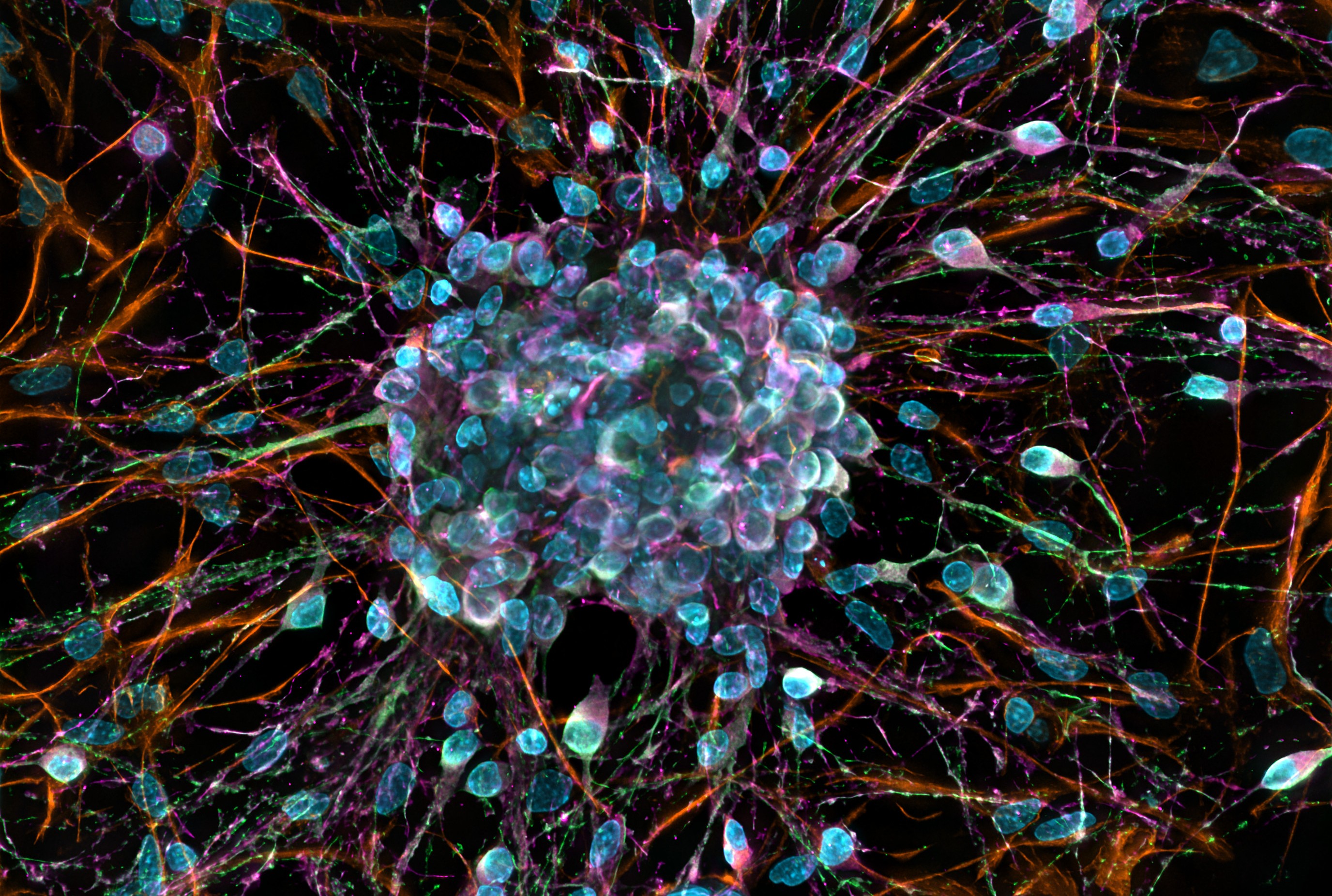 Image of rat primary cortical neurons in culture.